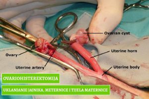 Ovariohisterektomija_uklanjanje-jajnika-maternice-i-tijela-maternice